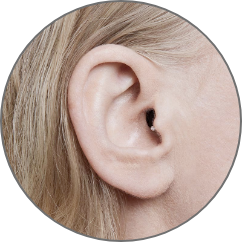 Im-Ohr-Hörgeräte